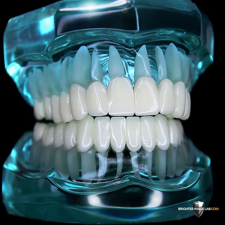 Veneers & Smile Design